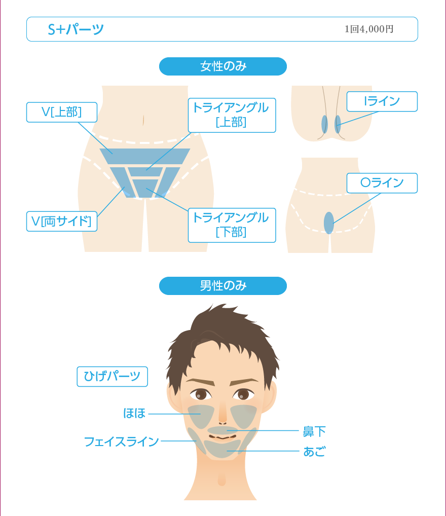 脱毛 S+パーツ